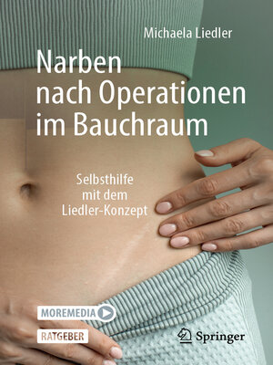 cover image of Narben nach Operationen im Bauchraum
